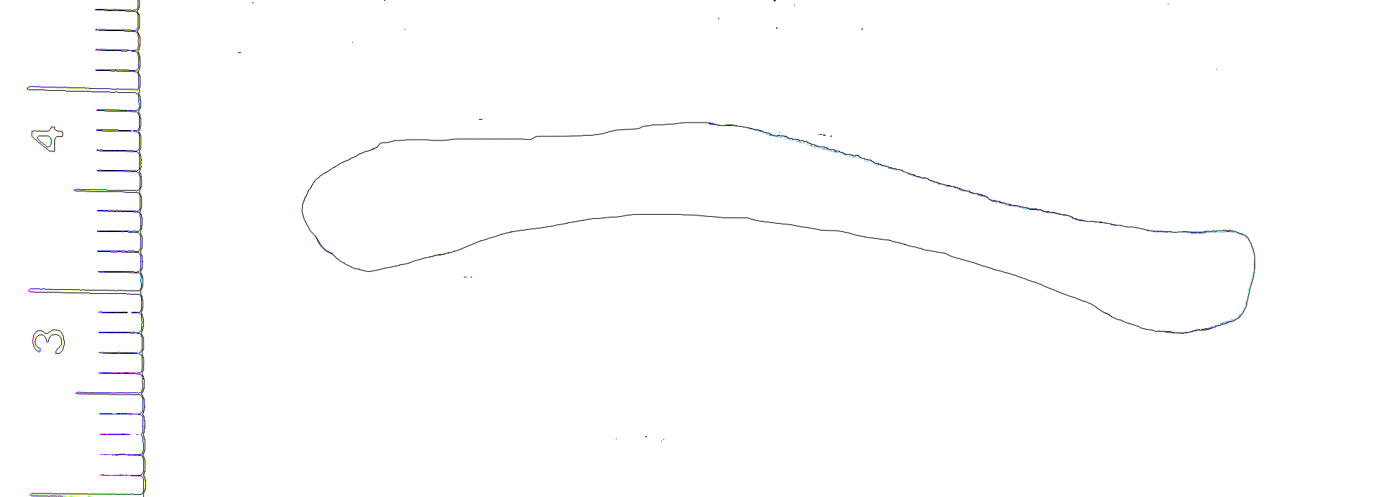 Iliac Crest