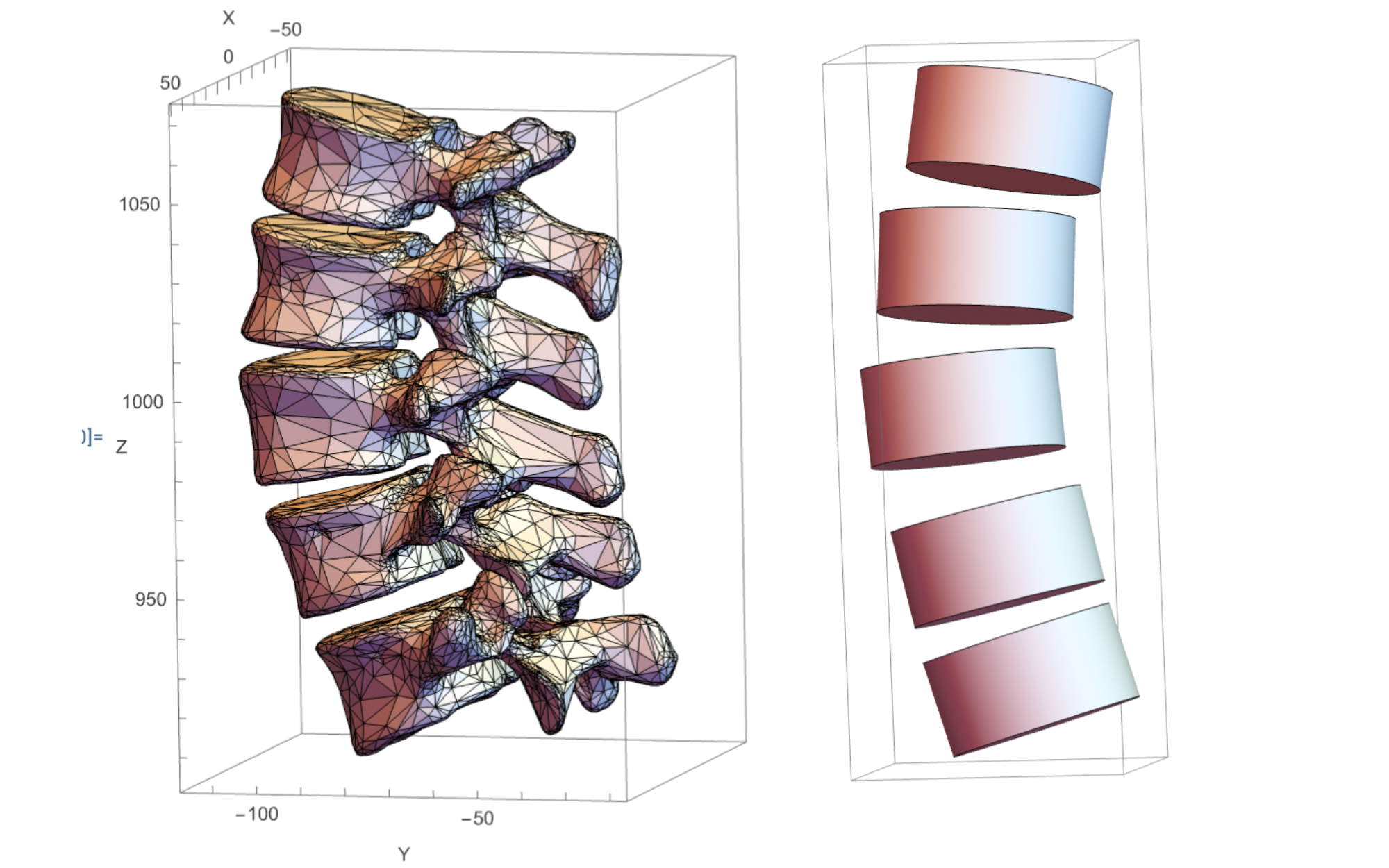 Modeling lumbar spine posture and Scoliotic deformation with proprioceptive feedback