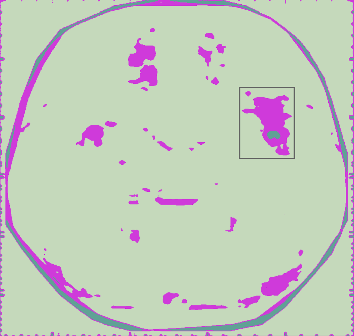 Visualization of average mean-difference plot for fMRI activation voxels; box around right putamen.