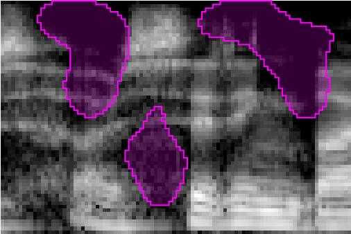 Mel Spectrogram with critical classification features highlighted