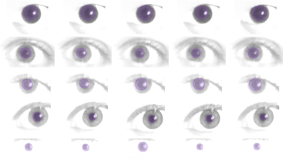 Image of Left eye data