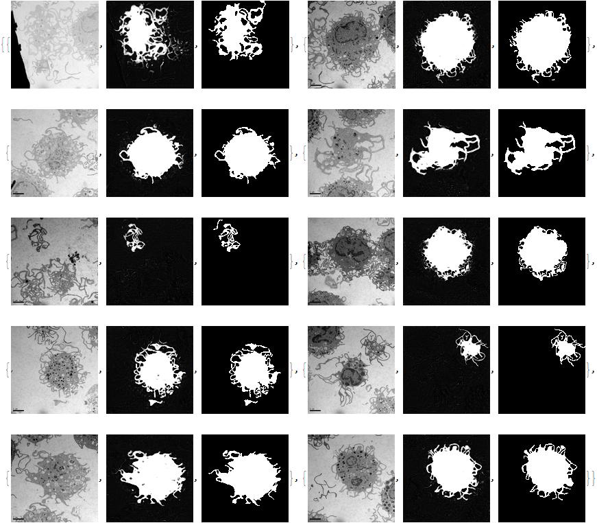Segmentation of Images in Transmission Electron Microscopic Cell Recordings