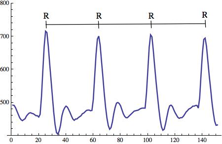 RR intervals