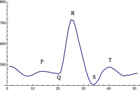 QRT structure of heart-beat.